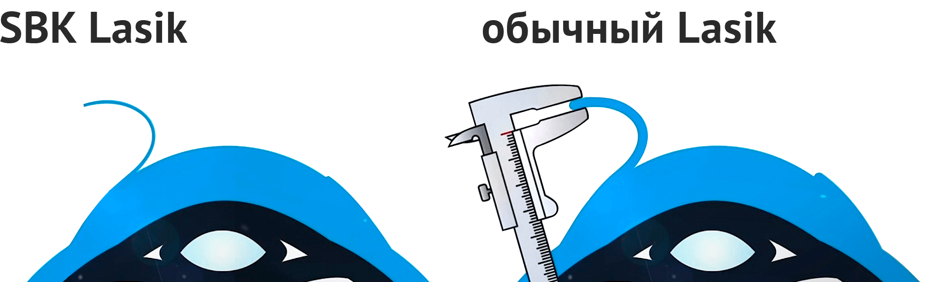 Эксклюзивная методика СБК-ЛАСИК